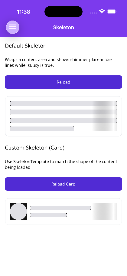 Default and custom skeleton loaders